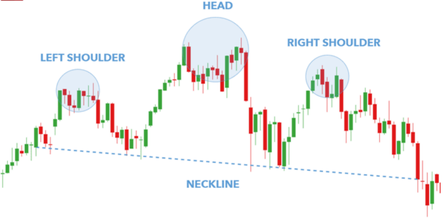 Inverse Head and Shoulder Pattern: A Complete Guide
